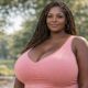 Woman's 89-Pound Breasts: Understanding Gigantomastia, a Rare Condition